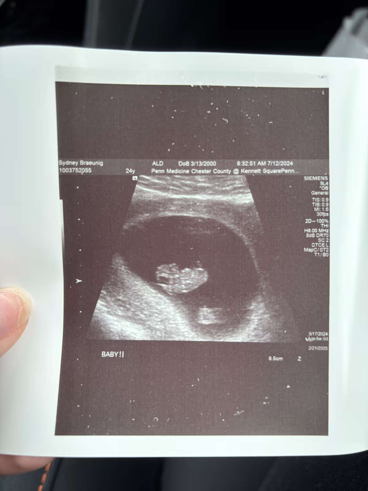 Ultrasound picture